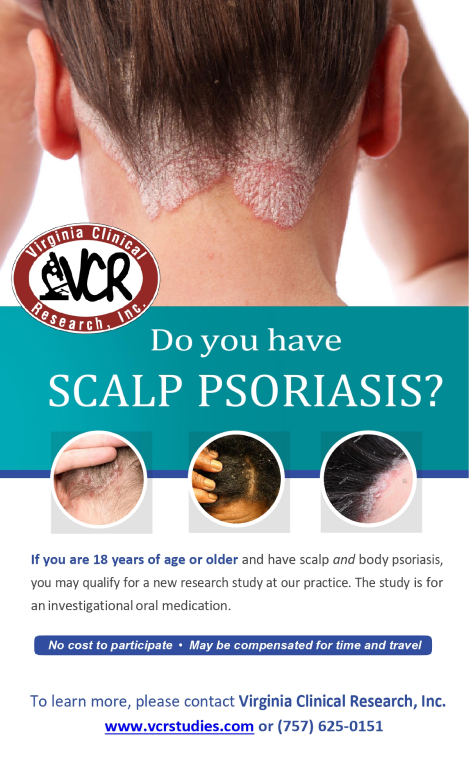 Scalp Psoriasis Flyer 