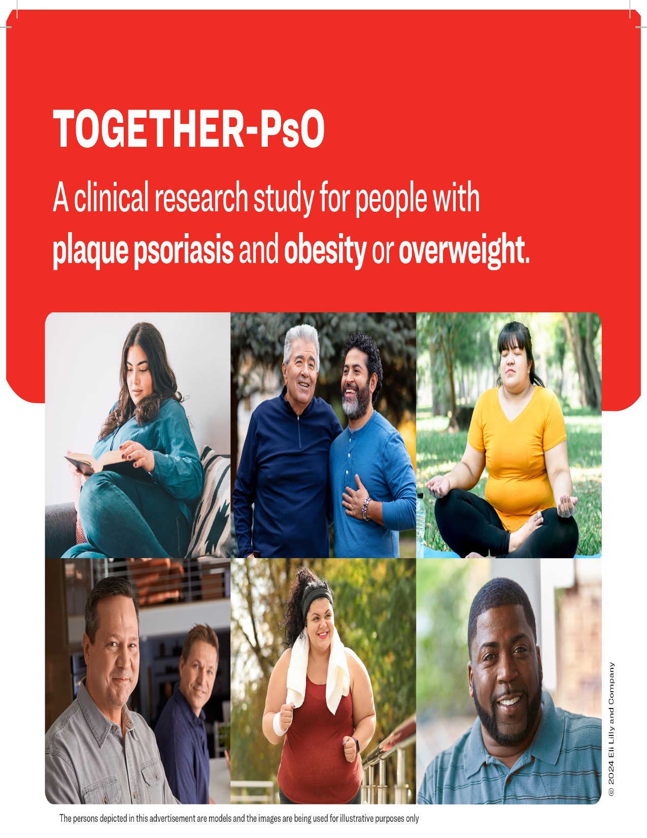Psoriasis and Weight Loss